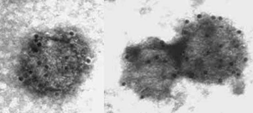 Bovine coronavirus, immunogold staining (TEM)